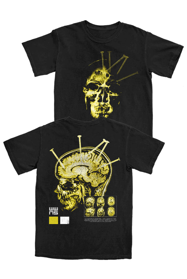 X-Ray Tee (Black)
